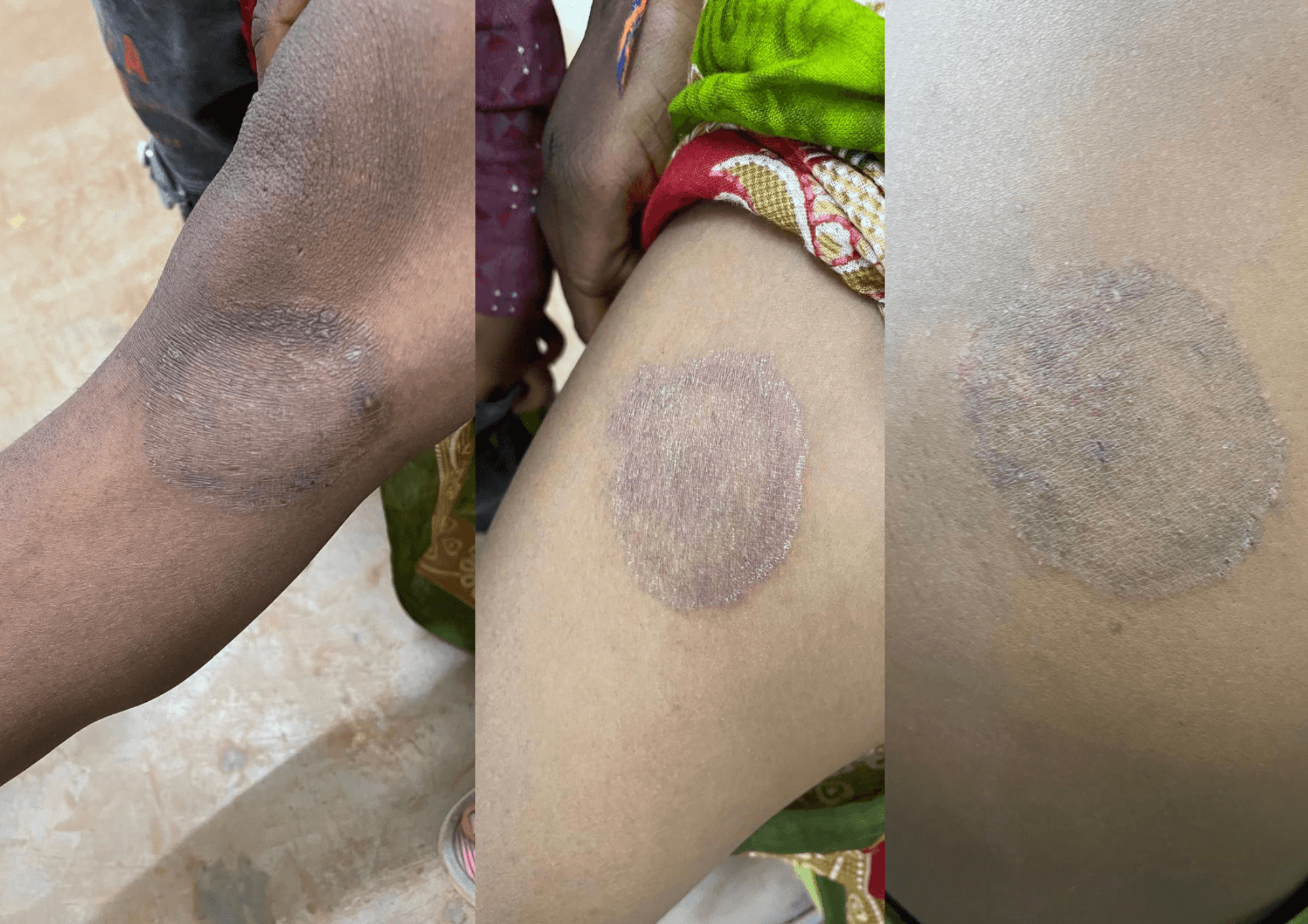 Sorry, we are in the process of creating alt