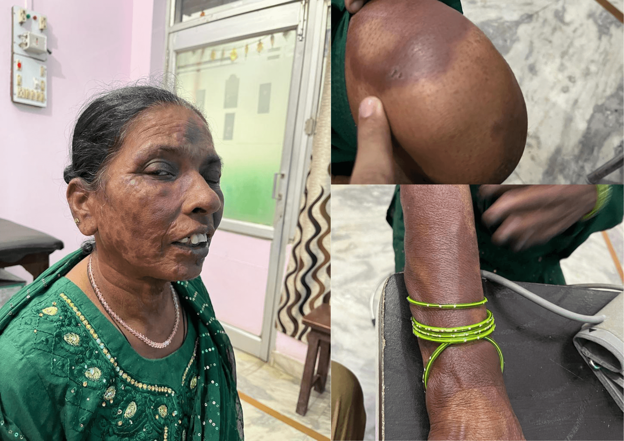 Sorry, we are in the process of creating alt