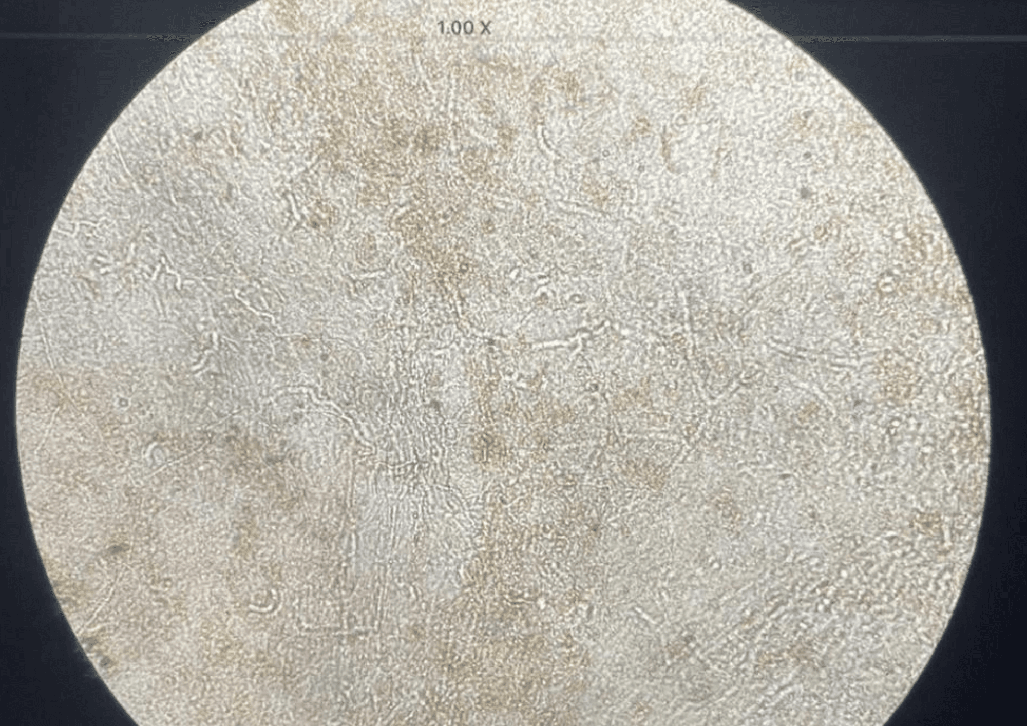 Sorry, we are in the process of creating alt