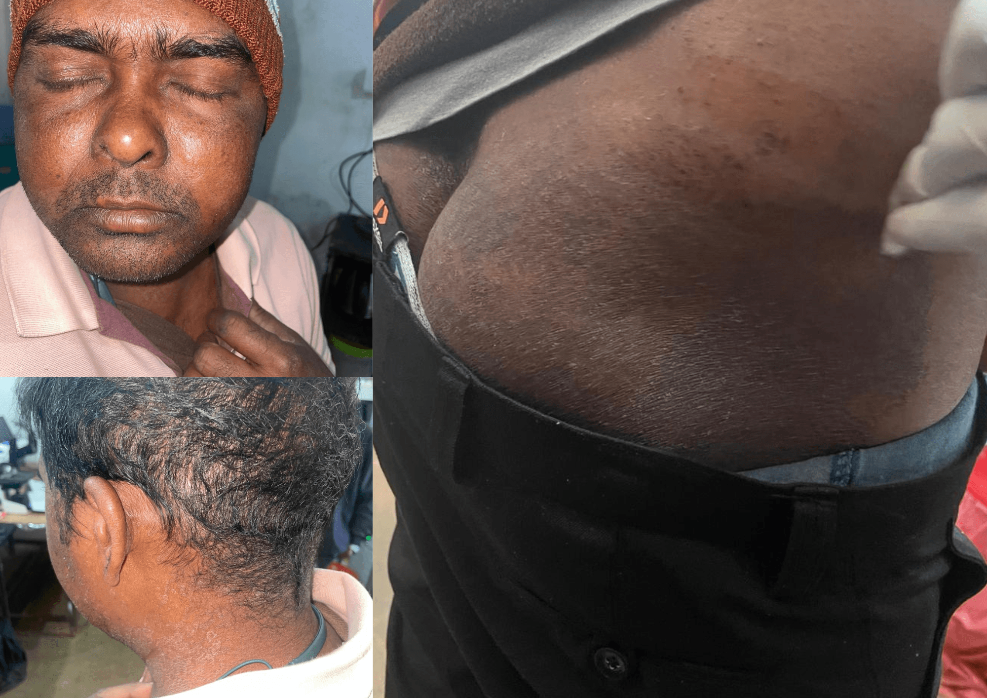 Sorry, we are in the process of creating alt